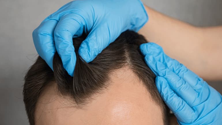Sapphire Hair Clinic – Best Hair Transplant Istanbul Experts